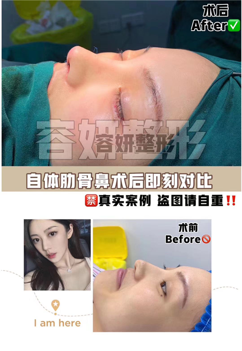 上海眼综合整形哪家好 