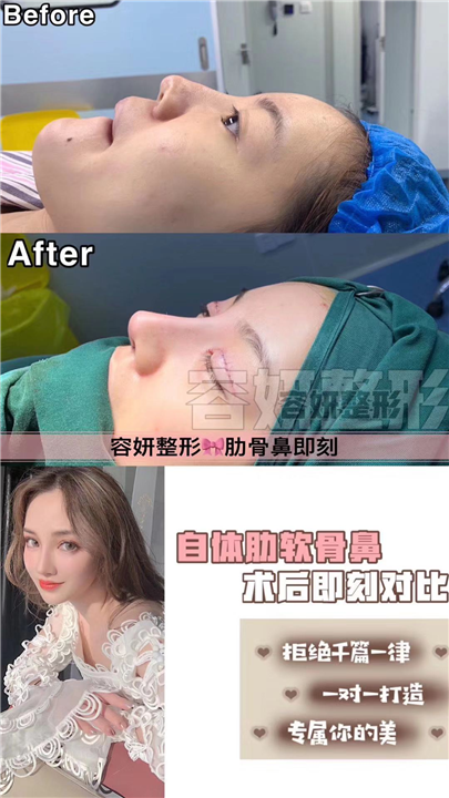 上海眼综合整形|佩佩医疗整形 