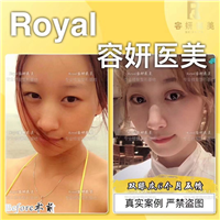 上海眼综合哪家专业 