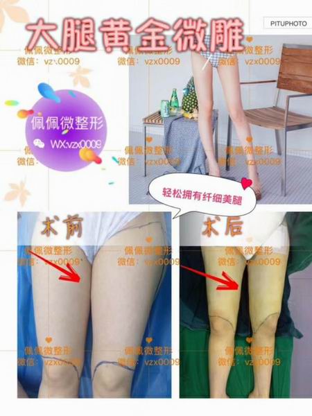 上海**专业的修复整形