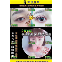 上海鼻综合整形 