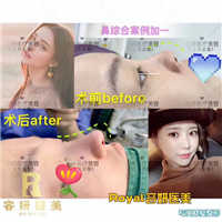 上海眼综合整形 
