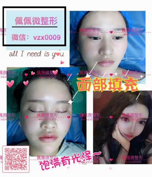 上海网红修复整形|上海网红整形哪家好