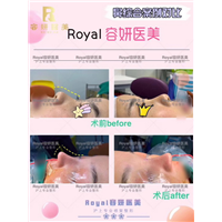 上海高级脸打造整形 
