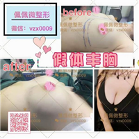 上海哪家网红整形专业