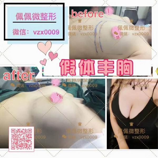 上海哪家网红整形专业