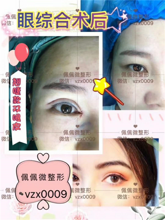 上海鼻综合整形哪家好 