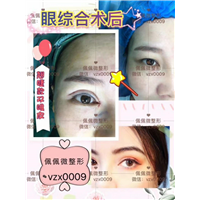 上海鼻综合整形哪家好 