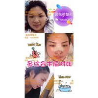 上海网红整形医院|上海佩佩医疗整形