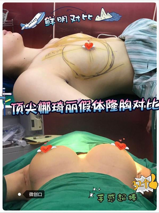 上海网红明星整形