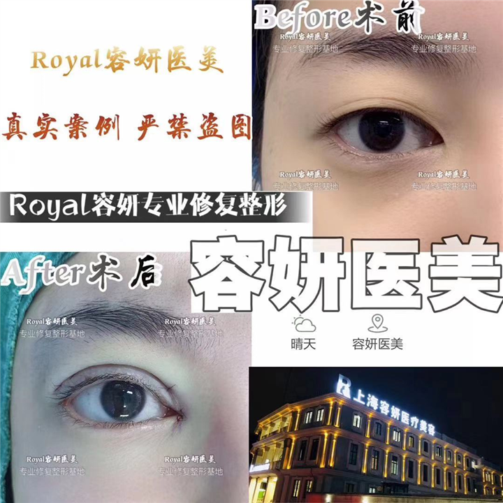 上海眼综合哪家专业 
