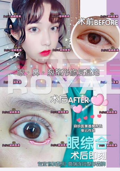上海脂肪隆胸整形