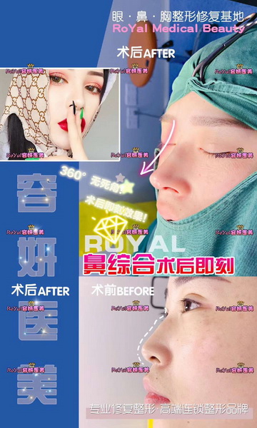 上海眼综合整形 