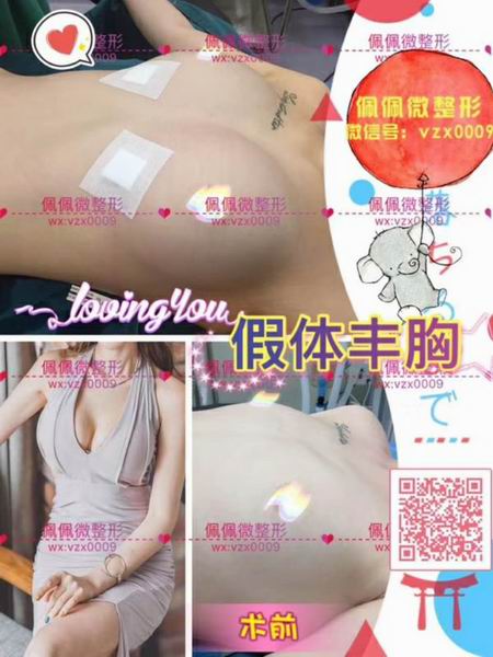 上海网红修复整形哪家好