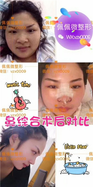上海网红整形医院|上海佩佩医疗整形