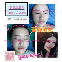 上海网红修复整形|上海网红整形哪家好