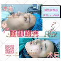 上海网红整形|上海网红修复整形