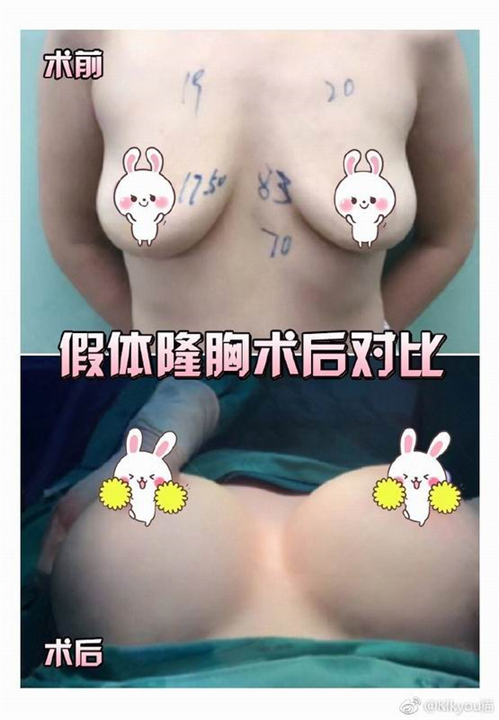 上海专业网红整形修复