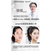 张铉磨骨整形专家