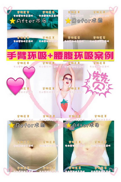 上海眼综合整形