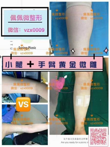 上海**专业的修复整形