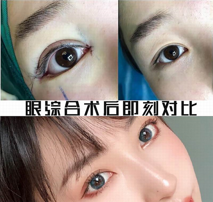 上海人气网红整形
