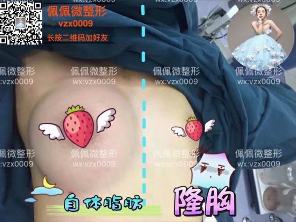 上海网红修复整形哪家好
