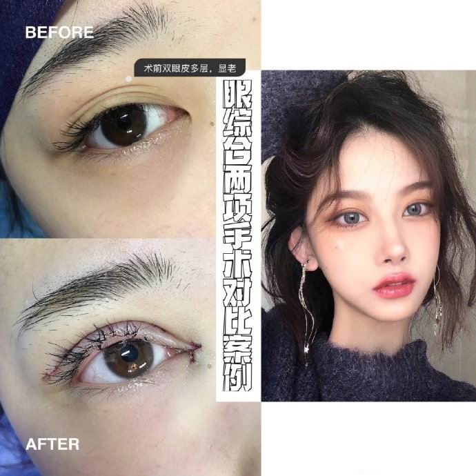上海人气网红整形