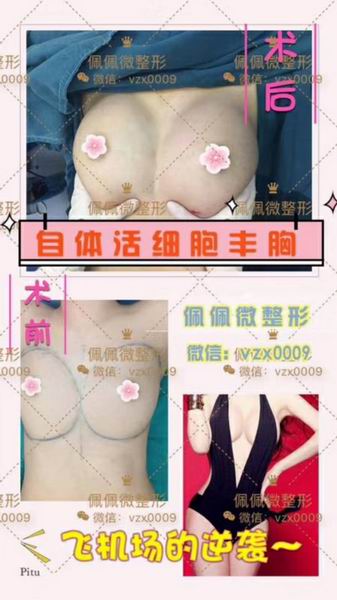 上海网红修复整形哪家好