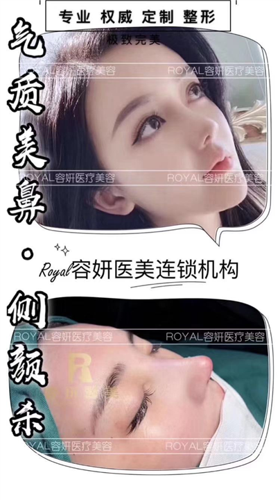 上海鼻综合整形 