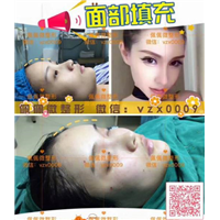 上海网红整形|上海网红修复整形