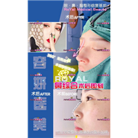 上海眼综合整形 