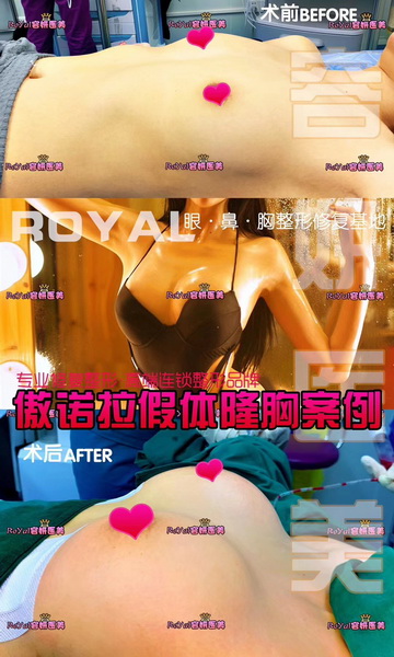 上海网红整形 