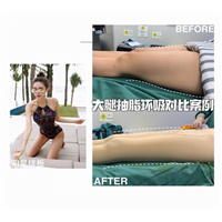 上海专业网红脸打造