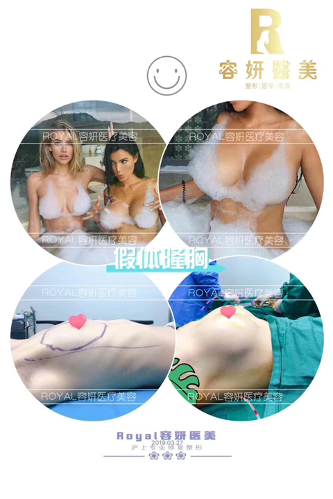 上海隆胸整形医院 