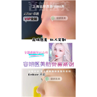 上海鼻综合整形哪家好 