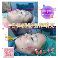 上海网红整形哪家好|上海哪家网红整形专业