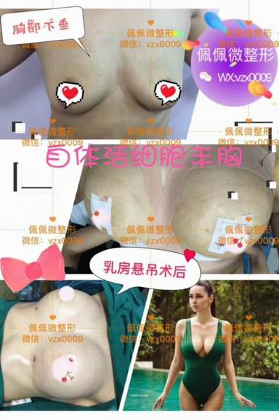 上海哪家网红整形专业