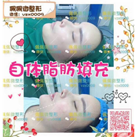 上海网红修复整形|上海网红整形哪家好