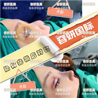 上海高级脸打造整形 
