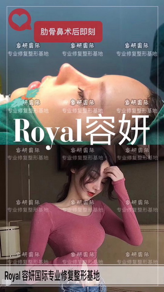 上海眼综合整形 