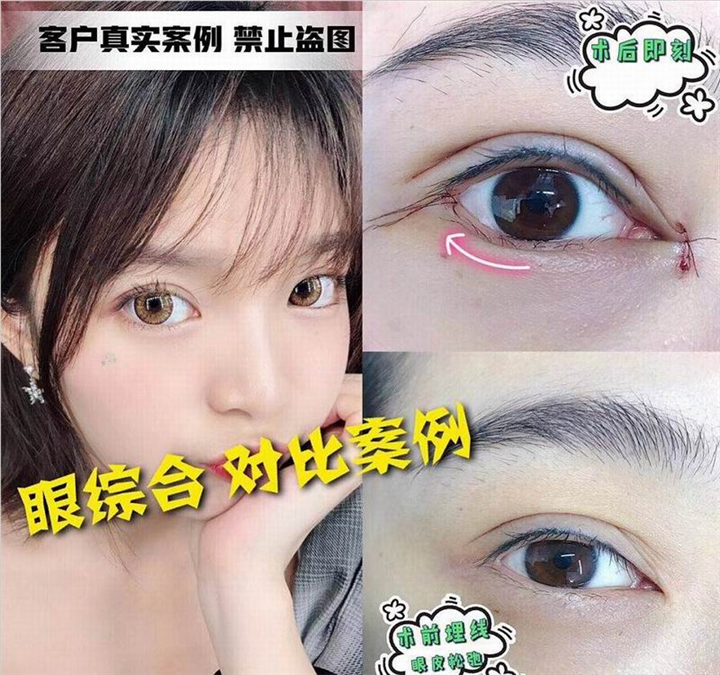 上海人气网红整形