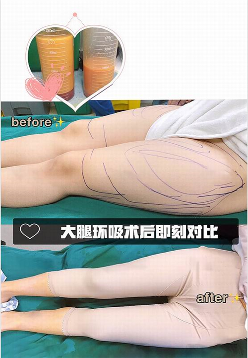 上海专业网红脸打造