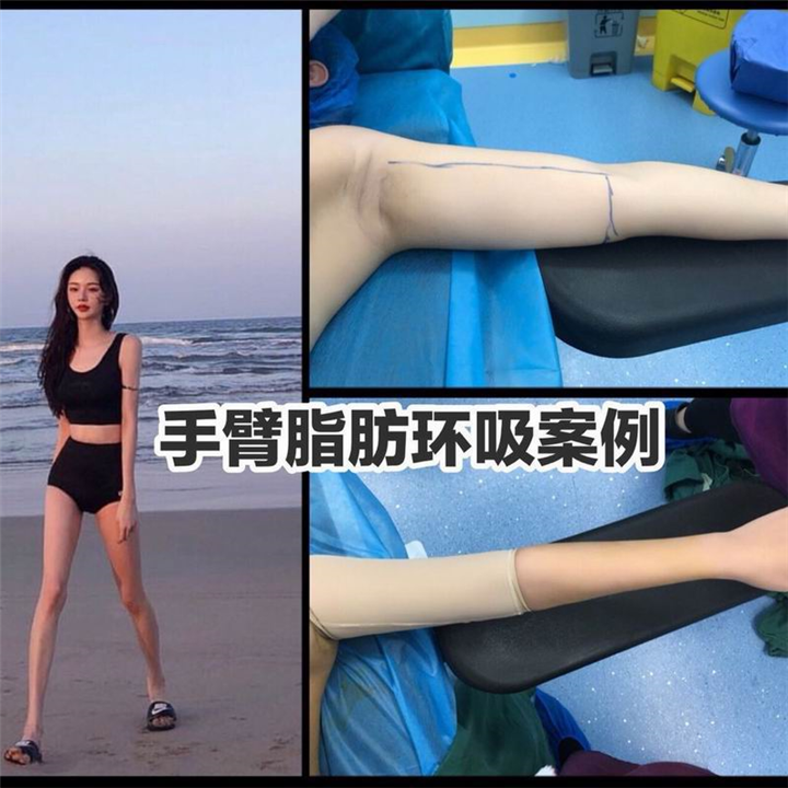 上海专业网红脸打造