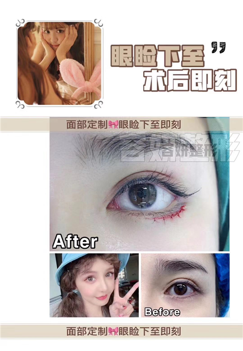 上海眼综合哪家专业 