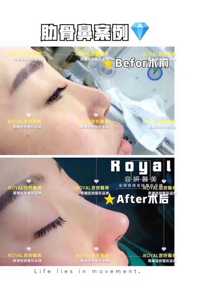 上海高级脸打造整形 