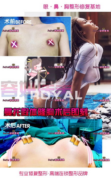 上海网红整形 