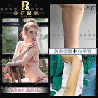 上海高级脸打造整形
