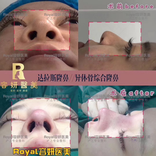 上海眼综合整形 