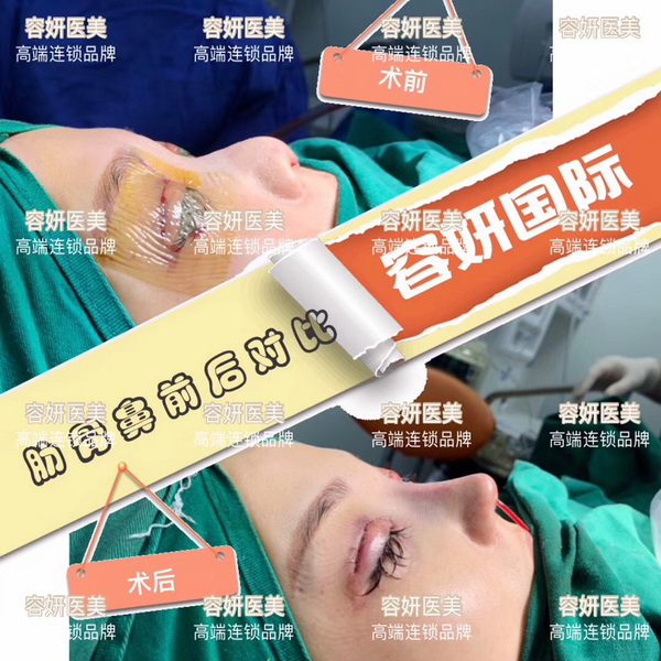 上海高级脸打造整形 